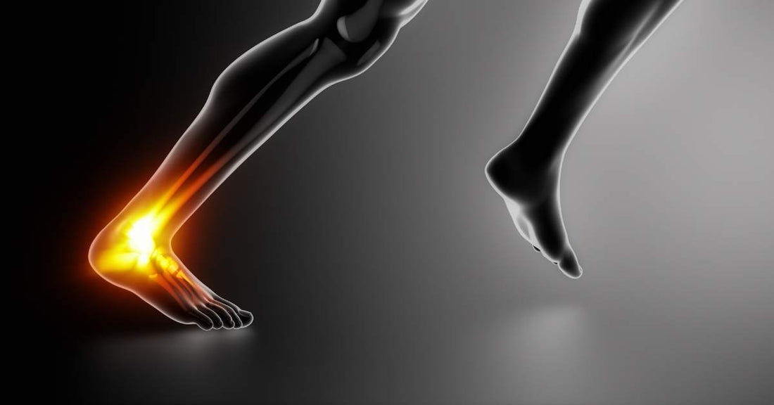 Courir avec une douleur au tendon d’Achille : faut-il arrêter ?